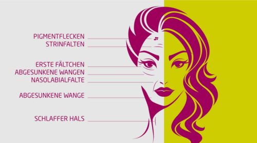 Facelifting-faltenunterspritzung-Augenbrauenlifting-koeln-Faltenbehandlung