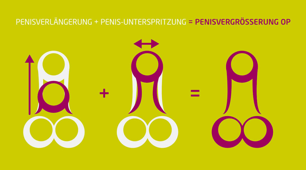 penisvergroesserung-op-koeln