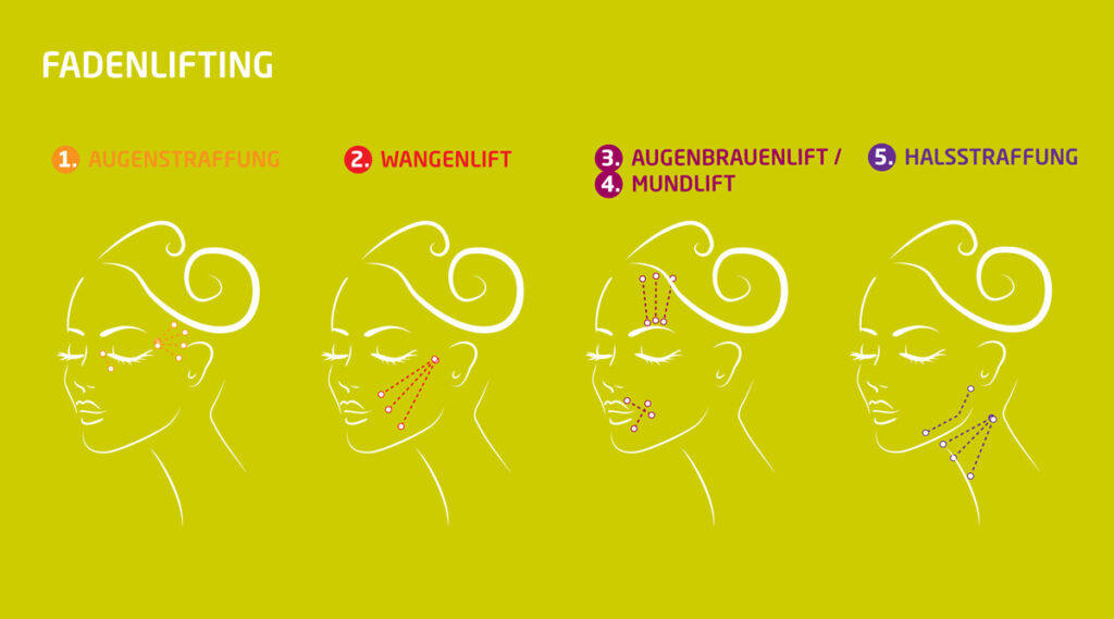 Methoden der Hautstraffung im Gesicht